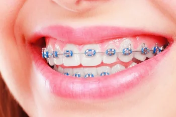 GNI-Ligature tie-1040pcs/pk second