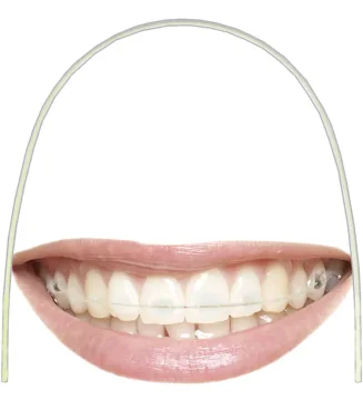 3B ORTHO-COATED NiTi Archwires second