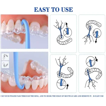 Orhodontic Aligner Removal