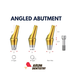 Angled Abutment