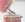 Orthodontic Appliances