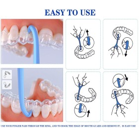 Orhodontic Aligner Removal