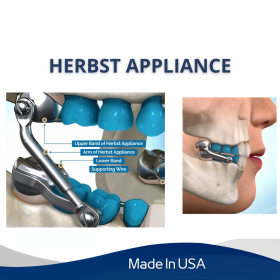 Herbst Appliance
