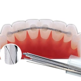 SS TWISTED STRAIGHT WIRE RETAINER