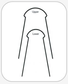 3B ORTHO-LINGUAL NiTi Archwires