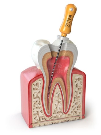 Endodontics