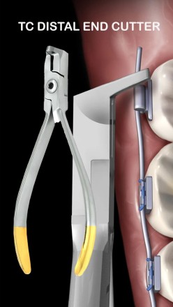 Distal End Cutters