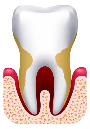Periodontics